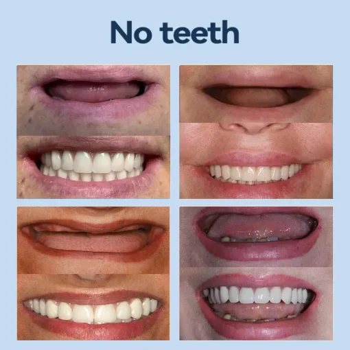 SmileFitPro® – Giảm cân hiệu quả