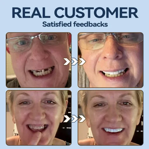 SmileFitPro® – Giảm cân hiệu quả