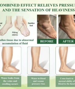 ATTDX® CircuFlex Leg Therapy Edema Spray