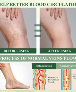 ATTDX® CircuFlex Leg Therapy Edema Spray