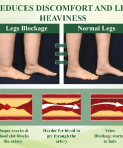 ATTDX® CircuFlex Leg Therapy Edema Spray