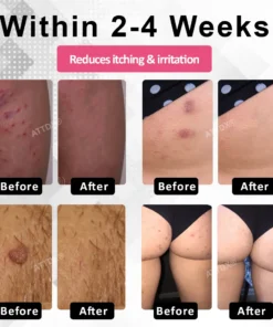 ATTDX® EndoLynx VulvaCare HPV Defense Cream