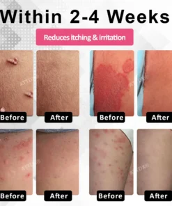 ATTDX® EndoLynx VulvaCare HPV Defense Cream