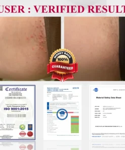 ATTDX® EndoLynx VulvaCare HPV Defense Cream