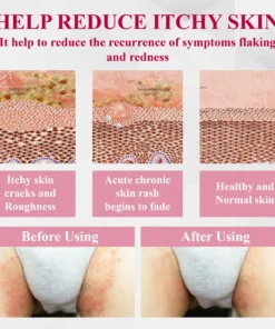 ATTDX® EndoLynx VulvaCare HPV Defense Cream