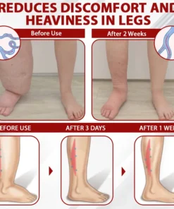 ATTDX® Red Vine FluidRelief Edema Gel