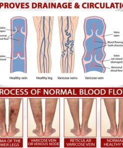 ATTDX® Red Vine FluidRelief Edema Gel