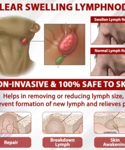 ATTDX® Red Vine FluidRelief Edema Gel