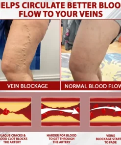 ATTDX® Red Vine FluidRelief Edema Gel