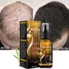 Bloobeac®Hair Growth Serum - Strong and Healthy Hair