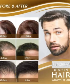Bloobeac®Hair Growth Serum - Strong and Healthy Hair
