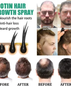 Bloobeac®Hair Growth Serum - Strong and Healthy Hair