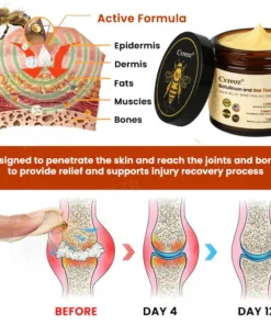 Cvreoz® Botulinum and Bee Toxin Pain Relief Bone Healing Cream