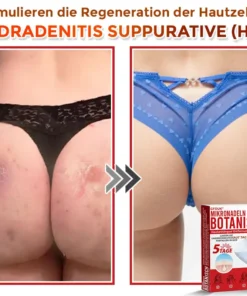 GFOUK® Mikronadeln Botanisch Hautanhängsel Entfernung Patch