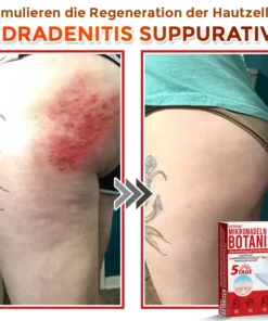 GFOUK® Mikronadeln Botanisch Hautanhängsel Entfernung Patch