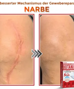 GFOUK® Mikronadeln Botanisch Hautanhängsel Entfernung Patch