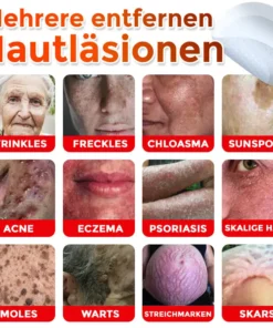 GFOUK® Mikronadeln Botanisch Hautanhängsel Entfernung Patch