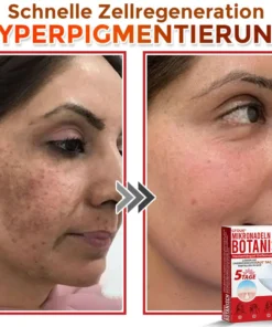 GFOUK® Mikronadeln Botanisch Hautanhängsel Entfernung Patch