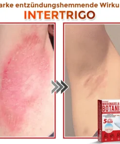 GFOUK® Mikronadeln Botanisch Hautanhängsel Entfernung Patch