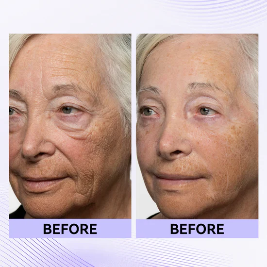 nstant Eye Tightener Easy-Wear Formula With Brush Free