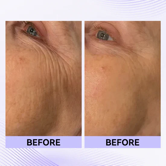 nstant Eye Tightener Easy-Wear Formula With Brush Free