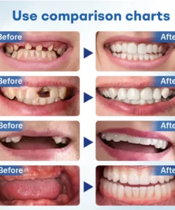 𝐍𝐮𝐫𝐛𝐢𝐧𝐢® 𝐓𝐡𝐞𝐫𝐦𝐨𝐒𝐞𝐚𝐥 𝐅𝐫𝐞𝐬𝐡 𝐃𝐞𝐧𝐭𝐮𝐫𝐞- ✅ Clinically proven to completely solve denture slippage and discomfort