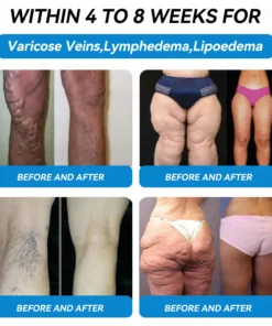 𝐃𝐢𝐚𝐩𝐚𝐬𝐨𝐧®👨‍🔬🎁 𝐺𝐿𝑃-1 & 𝑁𝑀𝑁+ 𝑊𝑒𝑖𝑔ℎ𝑡 𝐿𝑜𝑠𝑠 & 𝐵𝑙𝑜𝑜𝑑 𝑆𝑢𝑔𝑎𝑟 𝐶𝑜𝑛𝑡𝑟𝑜𝑙 𝐻𝑖𝑔ℎ𝑙𝑦 𝐸𝑓𝑓𝑒𝑐𝑡𝑖𝑣𝑒 𝑂𝑟𝑎𝑙 𝐿𝑖𝑞𝑢𝑖𝑑