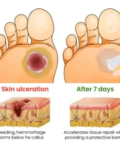 📢 Limited time offer Cvreoz® Diabetes Treatment Cream