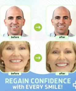 🌟 Official Store | Bikenda® Thermal Forming False Teeth🦷 Transform Your Smile with Confidence!