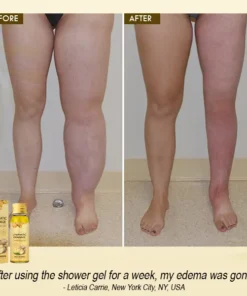 🌟 Official Store | Revitalize Your Body with Cvreoz® PRO Lymphatic Drainage Herbal Shower Gel!🔥 Your Natural Solution for Detox and Relief!💕