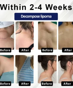 ATTDX® LipoEase Herbal Matrix-4 Cream