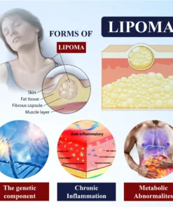 ATTDX® LipoEase Herbal Matrix-4 Cream