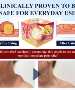 ATTDX® LipoEase Herbal Matrix-4 Cream