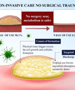ATTDX® LipoEase Herbal Matrix-4 Cream
