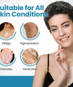 Bikenda® DermaBeam Vitiligo Therapy Device