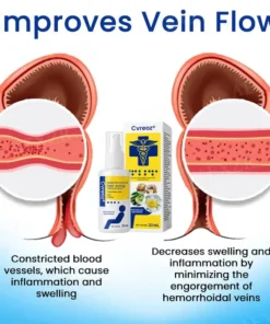 Cvreoz® Herbal Hemorrhoids Fast-Acting Treatment Spray