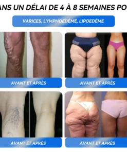 IFMAGIC® GLP-1 Pro Solution orale pour la perte de poids👩‍⚕️Une dose par jour—résultats visibles en 7 jours🥇