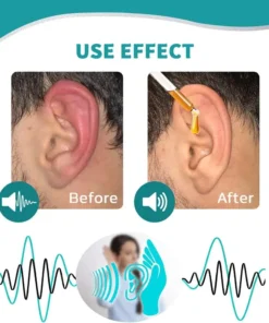 🔥New products now on sale - Limited time offer🔥 Skavix™ Ear Care Drops – Plant-Based Formula | FDA-Registered