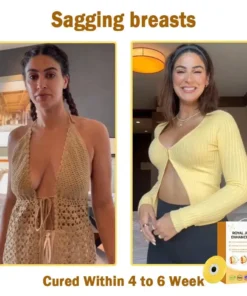 Newyuo™ 𝑹𝒐𝒚𝒂𝒍 𝑱𝒆𝒍𝒍𝒚 𝑩𝒓𝒆𝒂𝒔𝒕 𝑬𝒏𝒉𝒂𝒏𝒄𝒆𝒎𝒆𝒏𝒕 𝑷𝒂𝒕𝒄𝒉