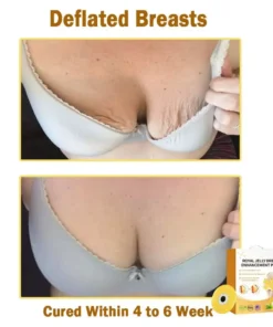 Newyuo™ 𝑹𝒐𝒚𝒂𝒍 𝑱𝒆𝒍𝒍𝒚 𝑩𝒓𝒆𝒂𝒔𝒕 𝑬𝒏𝒉𝒂𝒏𝒄𝒆𝒎𝒆𝒏𝒕 𝑷𝒂𝒕𝒄𝒉