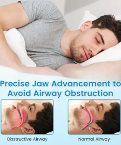 QIAWI™ Anti-Snoring Guard