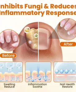 Timilk® FungiBee Advanced Nail Repair Spray