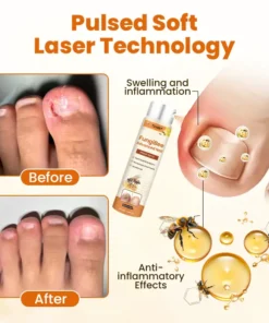 Timilk® FungiBee Advanced Nail Repair Spray