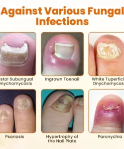 Timilk® FungiBee Advanced Nail Repair Spray