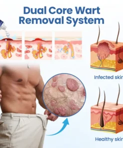 Timilk® GentX WartRelief Cream