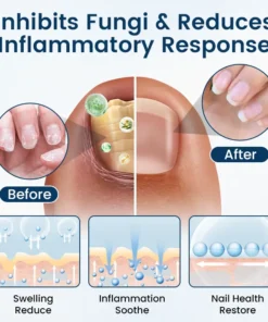 Timilk® OnyxiGuard Fungal Repair Herbal Spray