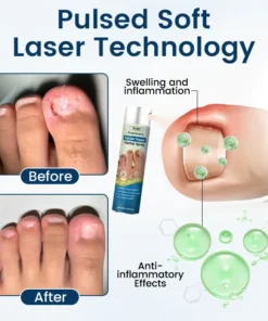 Timilk® OnyxiGuard Fungal Repair Herbal Spray