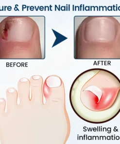 Timilk® OnyxiGuard Fungal Repair Herbal Spray