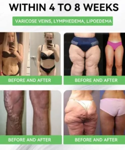 US 𝖮𝖿𝖿𝗂𝖼𝗂𝖺𝗅 𝖲𝗍𝗈𝗋𝖾 | 𝑩𝒖𝐢𝒍𝒅𝑳𝒆𝐚𝒇® GL𝐏-1 6-𝒊𝒏-1 𝑯𝒆𝒂𝒍𝒕𝒉 𝑺𝒐𝒍𝒖𝒕𝒊𝒐𝒏 𝖮𝗋𝖺𝗅 𝐋𝐢𝐪𝐮𝐢𝐝 (𝑱𝒖𝒔𝒕 𝒐𝒏𝒄𝒆 𝒂 𝒅𝒂𝒚, 𝘃𝗶𝘀𝗶𝗯𝗹𝗲 𝗰𝗵𝗮𝗻𝗴𝗲𝘀 𝗶𝗻 𝟳 𝗱𝗮𝘆𝘀） ✅ 𝘍𝘰𝘳 𝘰𝘣𝘦𝘴𝘪𝘵𝘺, 𝘤𝘢𝘳𝘥𝘪𝘰𝘷𝘢𝘴𝘤𝘶𝘭𝘢𝘳 𝘩𝘦𝘢𝘭𝘵𝘩,𝙙𝙞𝙖𝙗𝙚𝙩𝙚𝙨, 𝙨𝙡𝙚𝙚𝙥 𝐚𝐩𝐧𝐞𝐚, 𝐆𝐮𝐭 𝐇𝐞𝐚𝐥𝐭𝐡, 𝐣𝐨𝐢𝐧𝐭 𝐢𝐬𝐬𝐮𝐞𝐬, 𝐚𝐧𝐝 𝐦𝐨𝐫𝐞