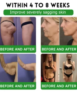 US 𝖮𝖿𝖿𝗂𝖼𝗂𝖺𝗅 𝖲𝗍𝗈𝗋𝖾 | 𝑩𝒖𝐢𝒍𝒅𝑳𝒆𝐚𝒇® GL𝐏-1 6-𝒊𝒏-1 𝑯𝒆𝒂𝒍𝒕𝒉 𝑺𝒐𝒍𝒖𝒕𝒊𝒐𝒏 𝖮𝗋𝖺𝗅 𝐋𝐢𝐪𝐮𝐢𝐝 (𝑱𝒖𝒔𝒕 𝒐𝒏𝒄𝒆 𝒂 𝒅𝒂𝒚, 𝘃𝗶𝘀𝗶𝗯𝗹𝗲 𝗰𝗵𝗮𝗻𝗴𝗲𝘀 𝗶𝗻 𝟳 𝗱𝗮𝘆𝘀） ✅ 𝘍𝘰𝘳 𝘰𝘣𝘦𝘴𝘪𝘵𝘺, 𝘤𝘢𝘳𝘥𝘪𝘰𝘷𝘢𝘴𝘤𝘶𝘭𝘢𝘳 𝘩𝘦𝘢𝘭𝘵𝘩,𝙙𝙞𝙖𝙗𝙚𝙩𝙚𝙨, 𝙨𝙡𝙚𝙚𝙥 𝐚𝐩𝐧𝐞𝐚, 𝐆𝐮𝐭 𝐇𝐞𝐚𝐥𝐭𝐡, 𝐣𝐨𝐢𝐧𝐭 𝐢𝐬𝐬𝐮𝐞𝐬, 𝐚𝐧𝐝 𝐦𝐨𝐫𝐞